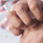 Man scratching his hand
