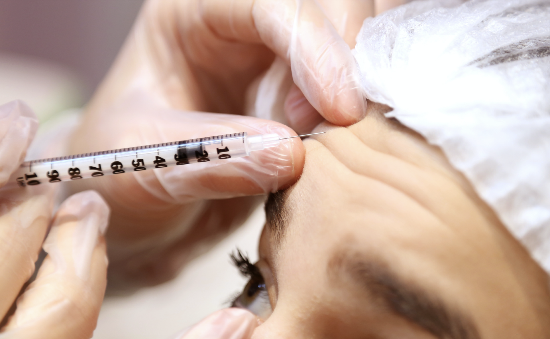 Doctor injecting botox into patient's forehead