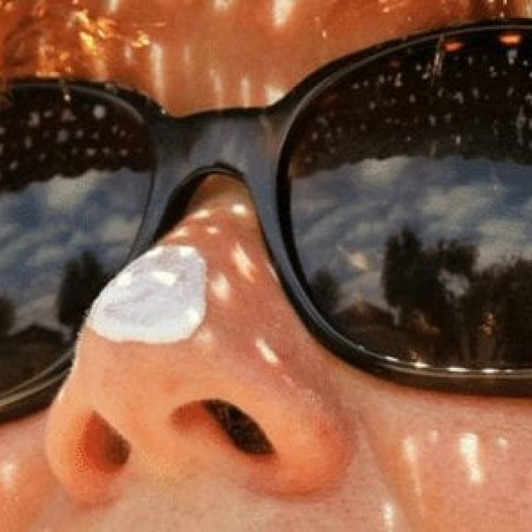 Close up of woman's face with sunglasses and sunscreen on her nose