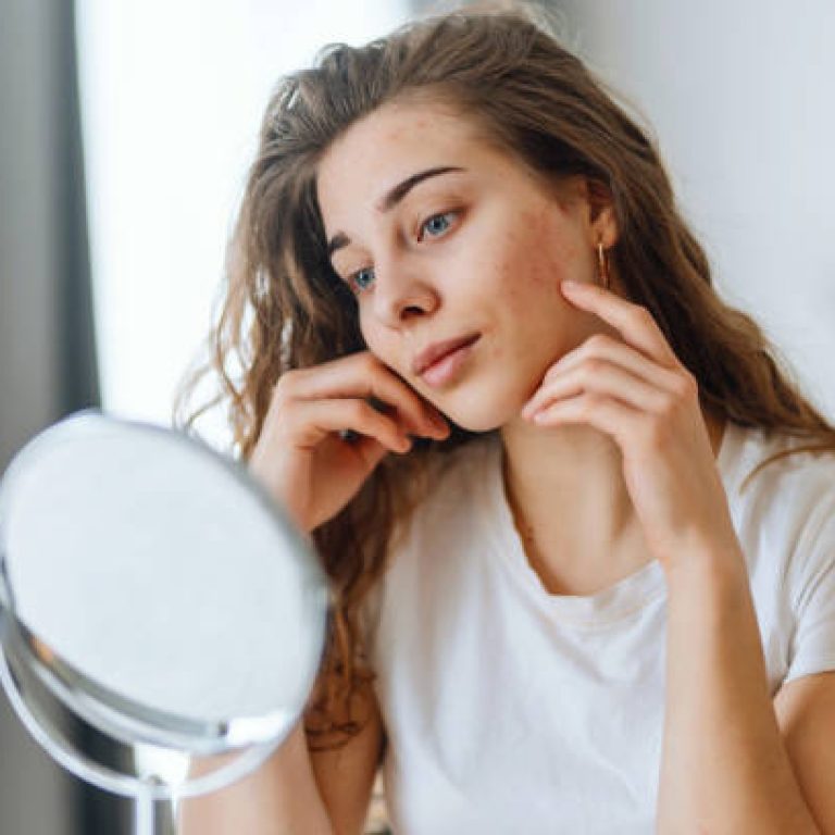 Image illustrating Back to School Without Acne: Tips for Teens and Adults