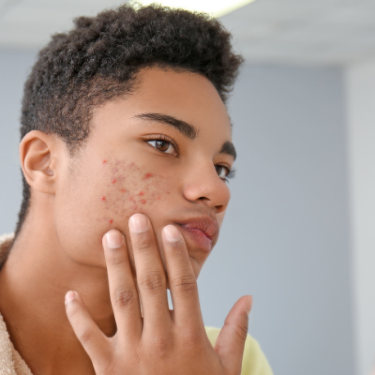 Image illustrating Back to School + Charleston Dermatology = Confidence and Clear Skin