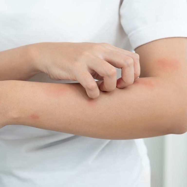 Image illustrating Don't Get Left Out in the Cold: A Guide to Winter Skin Conditions