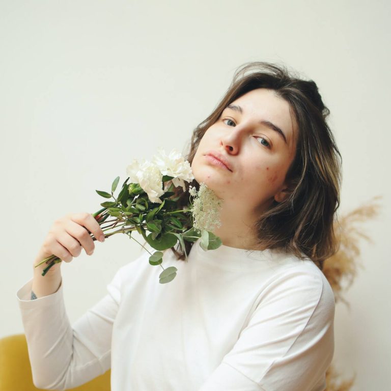 Woman with pimples holding white flowers