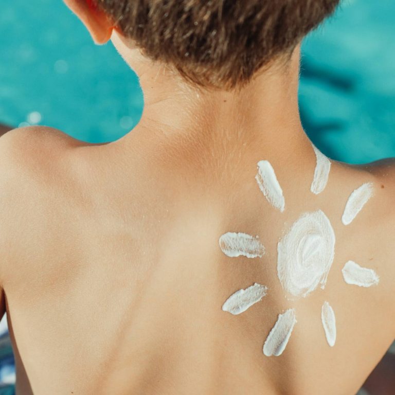 Sunscreen in the design of a sun on a little boys back