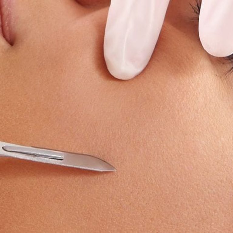 Doctor shaving a woman's face